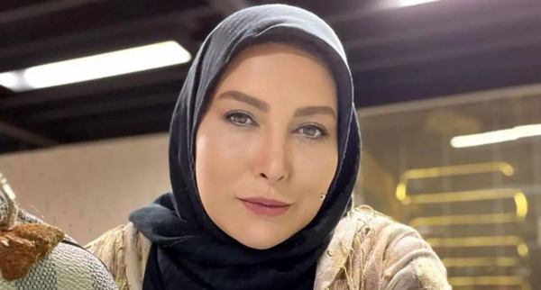 عکس قبل عمل بینی فریبا نادری