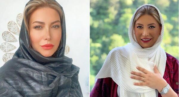 عکس قبل عمل بینی فریبا نادری