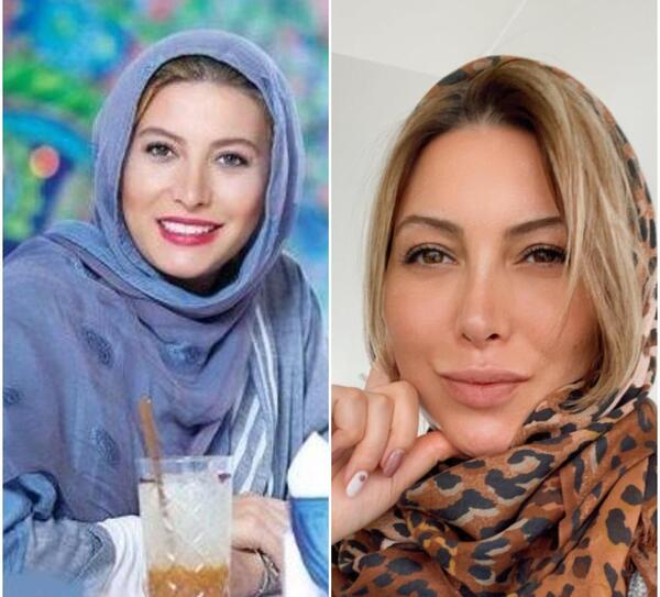 عکس قبل عمل بینی فریبا نادری