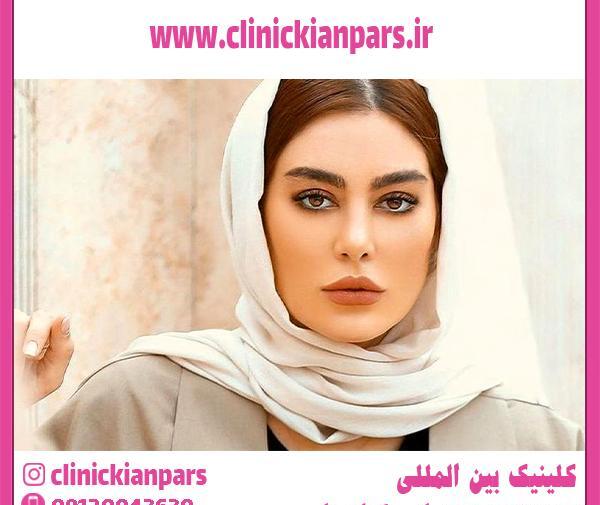 عکس های سحر قریشی قبل از عمل زیبایی