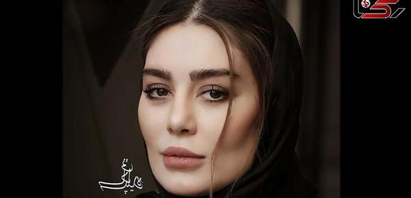 عکس های سحر قریشی قبل از عمل زیبایی