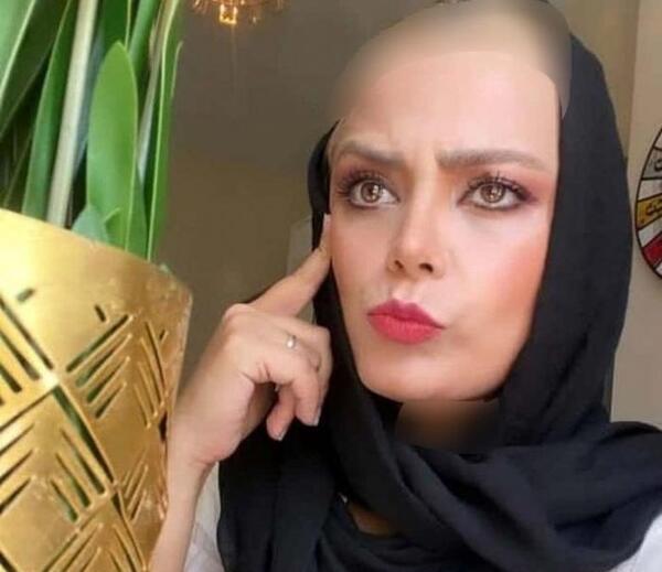 عکس قبل از عمل فحریه اوجن