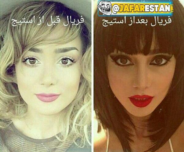 عکس فریال قبل عمل