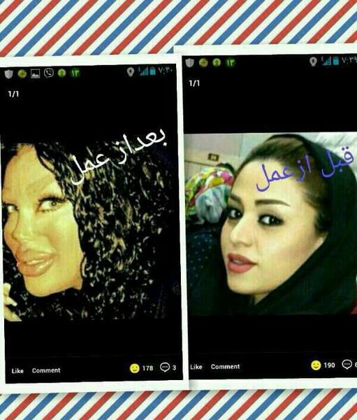 عکس فریال قبل عمل