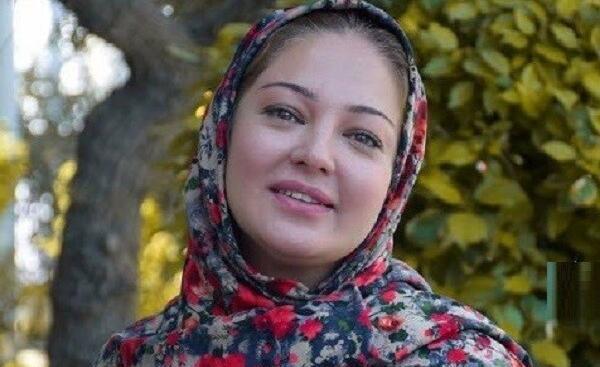 عکس قبل و بعد عمل رزیتا غفاری