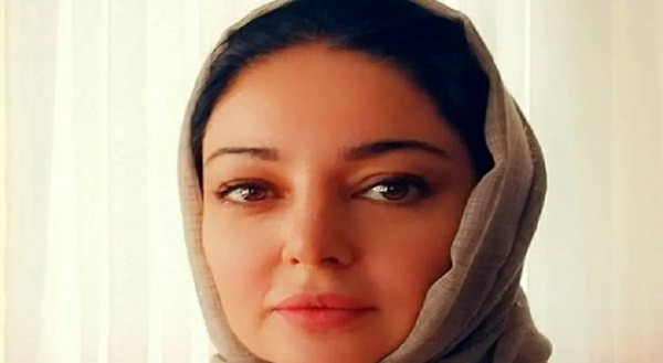 عکس قبل و بعد عمل رزیتا غفاری