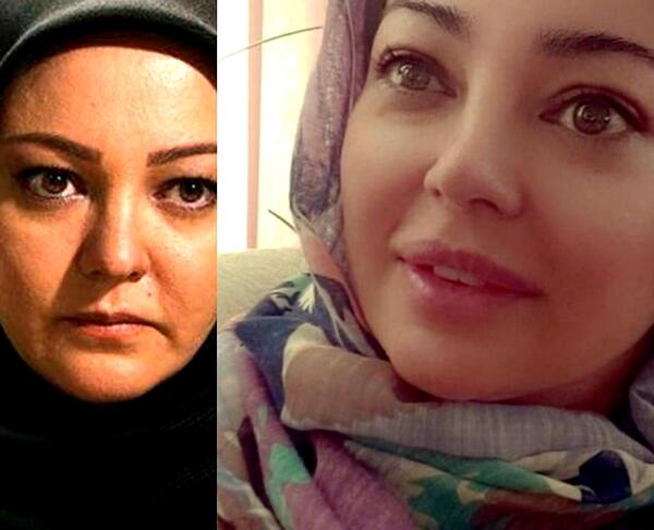 عکس قبل و بعد عمل رزیتا غفاری
