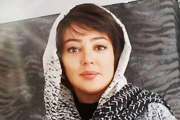 عکس قبل و بعد عمل رزیتا غفاری