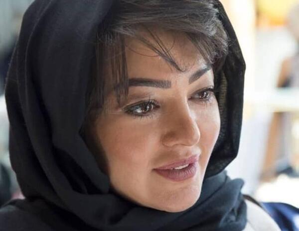 عکس قبل و بعد عمل رزیتا غفاری