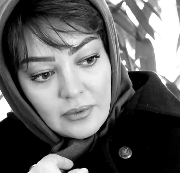 عکس قبل و بعد عمل رزیتا غفاری