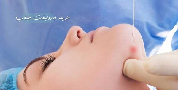 عکس های قبل و بعد از عمل غبغب
