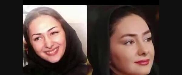 عکس قبل و بعد عمل نیلی افشار