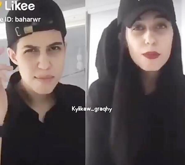 عکس قبل عمل شکیب غلامی