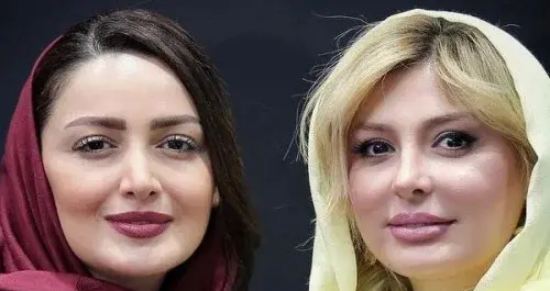 عکس قبل عمل بینی طناز طباطبایی
