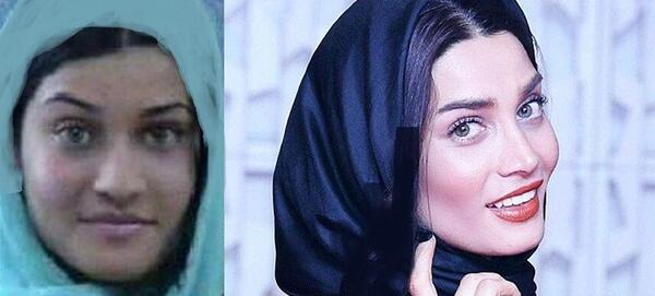 عکس قبل عمل بینی طناز طباطبایی