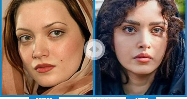 عکس قبل عمل بینی طناز طباطبایی
