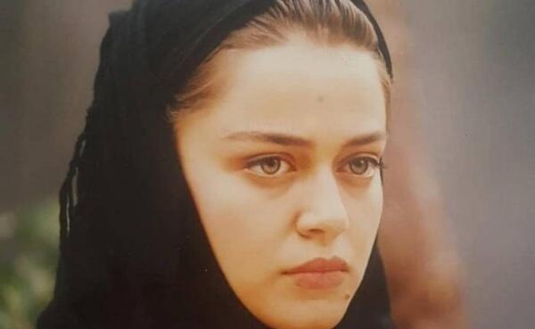 عکس طاها بهمنی قبل از عمل