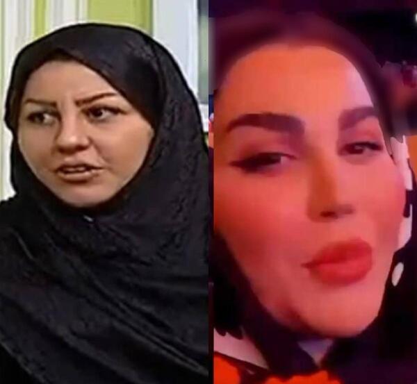 عکس طاها بهمنی قبل از عمل