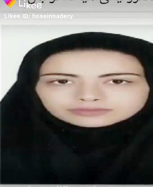 عکس های طاها بهمنی قبل از عمل
