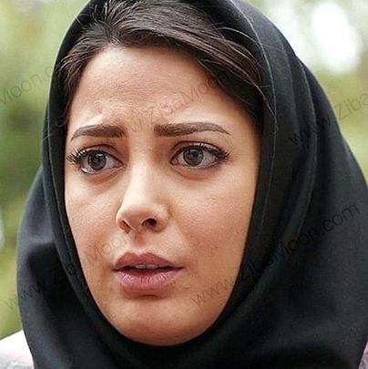 عکس قبل از عمل طناز طباطبایی
