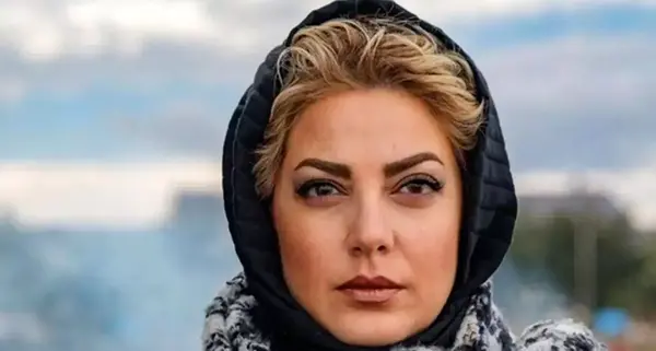 عکس قبل از عمل طناز طباطبایی
