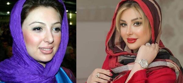 عکس قبل و بعد طناز طباطبایی