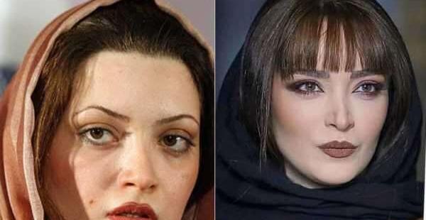 عکس قبل و بعد طناز طباطبایی