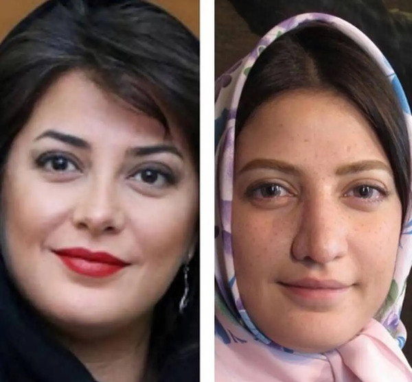 عکس قبل و بعد طناز طباطبایی