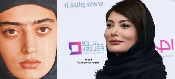 عکس قبل و بعد عمل طناز طباطبایی