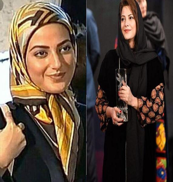 عکس قبل و بعد عمل طناز طباطبایی