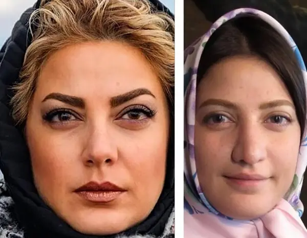 عکس قبل و بعد عمل طناز طباطبایی