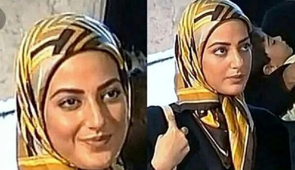 عکس قبل و بعد عمل طناز طباطبایی