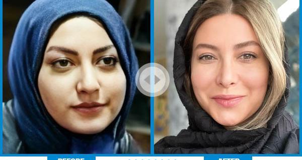 عکس قبل و بعد عمل طناز طباطبایی
