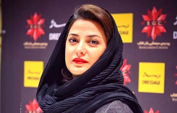 عکس قبل از عمل زیبایی طناز طباطبایی