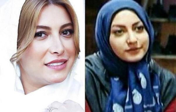 عکس قبل از عمل زیبایی طناز طباطبایی
