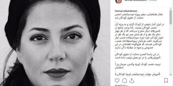 عکس قبل از عمل زیبایی طناز طباطبایی
