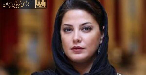 عکس قبل از عمل زیبایی طناز طباطبایی
