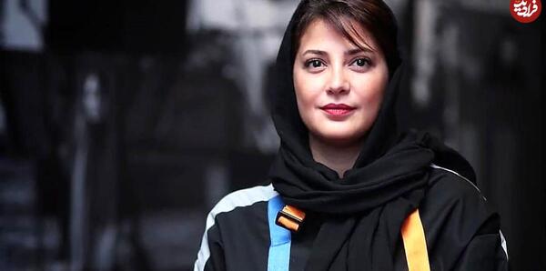 عکس قبل از عمل زیبایی طناز طباطبایی