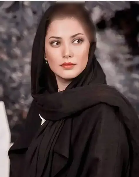 عکس قبل از عمل زیبایی طناز طباطبایی