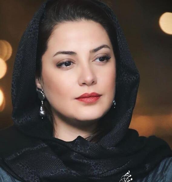 عکس قبل از عمل زیبایی طناز طباطبایی