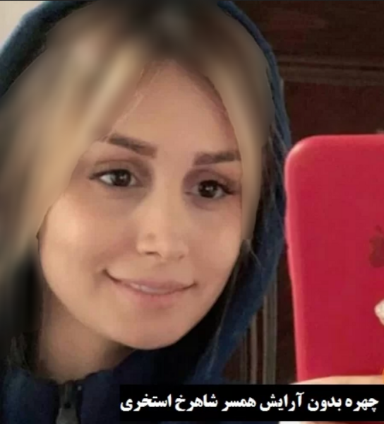 عکس قبل عمل شاهرخ استخری