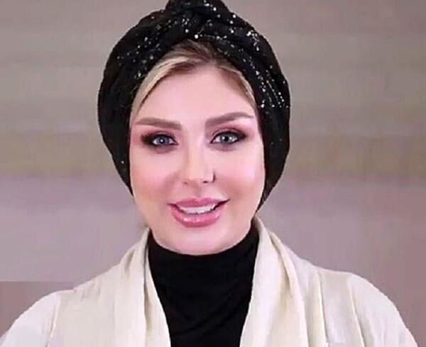 عکس قبل و بعد عمل بینی نیوشا ضیغمی