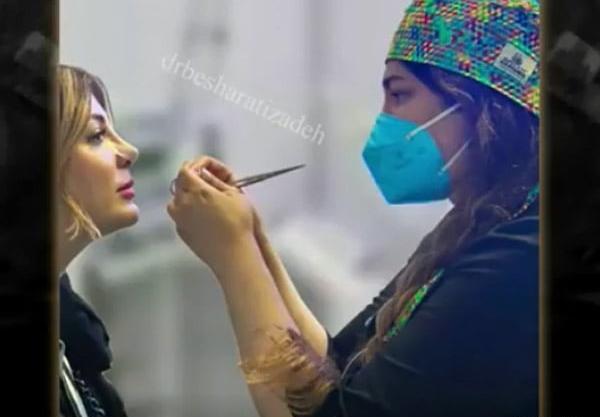 عکس قبل و بعد عمل بینی نیوشا ضیغمی
