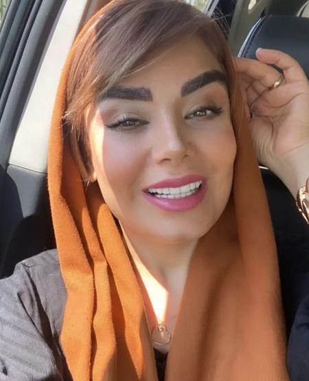 عکس قبل از عمل صبا راد