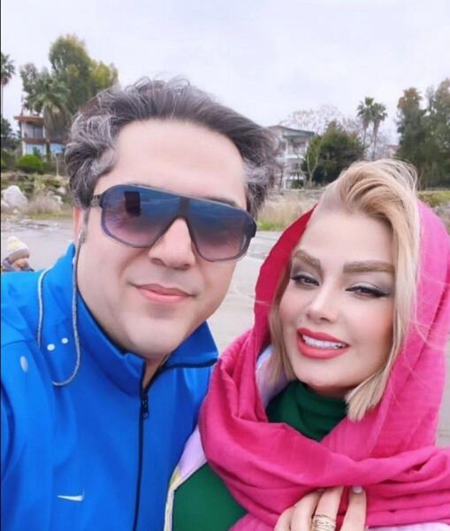 عکس قبل از عمل صبا راد