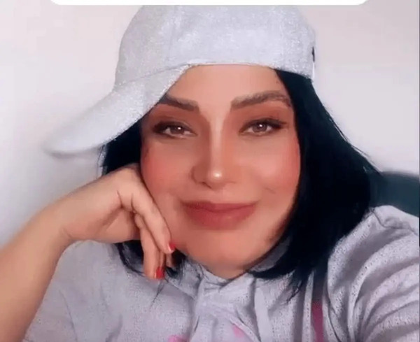 عکس قبل از عمل صبا راد
