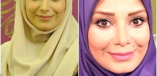 عکس قبل از عمل صبا راد