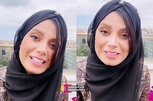 عکس قبل از عمل صبا راد