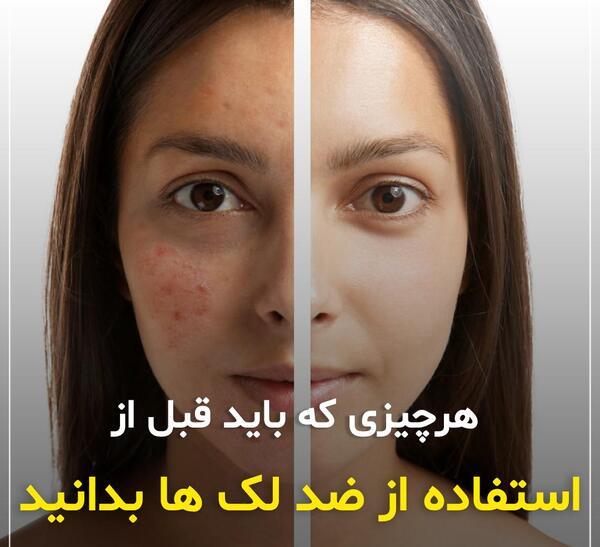 عکس قبل و بعد لک صورت