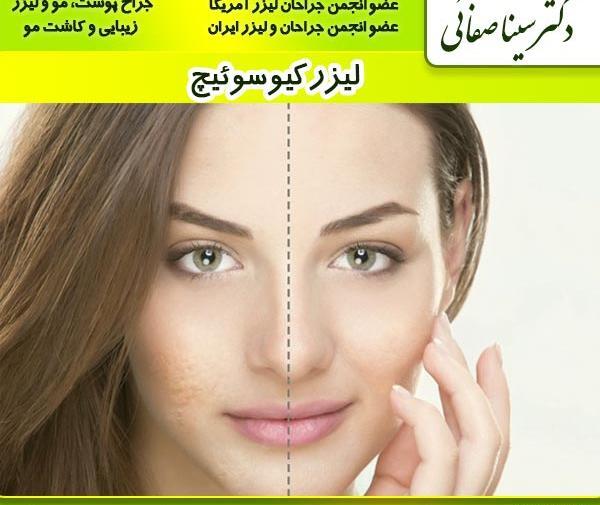 عکس قبل و بعد لک صورت